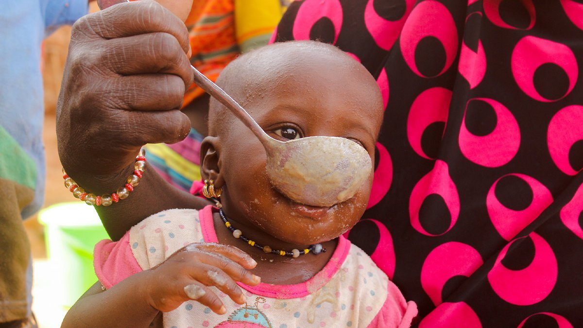 Ein Kleinkind wird mit spezieller Nahrung gefüttert.