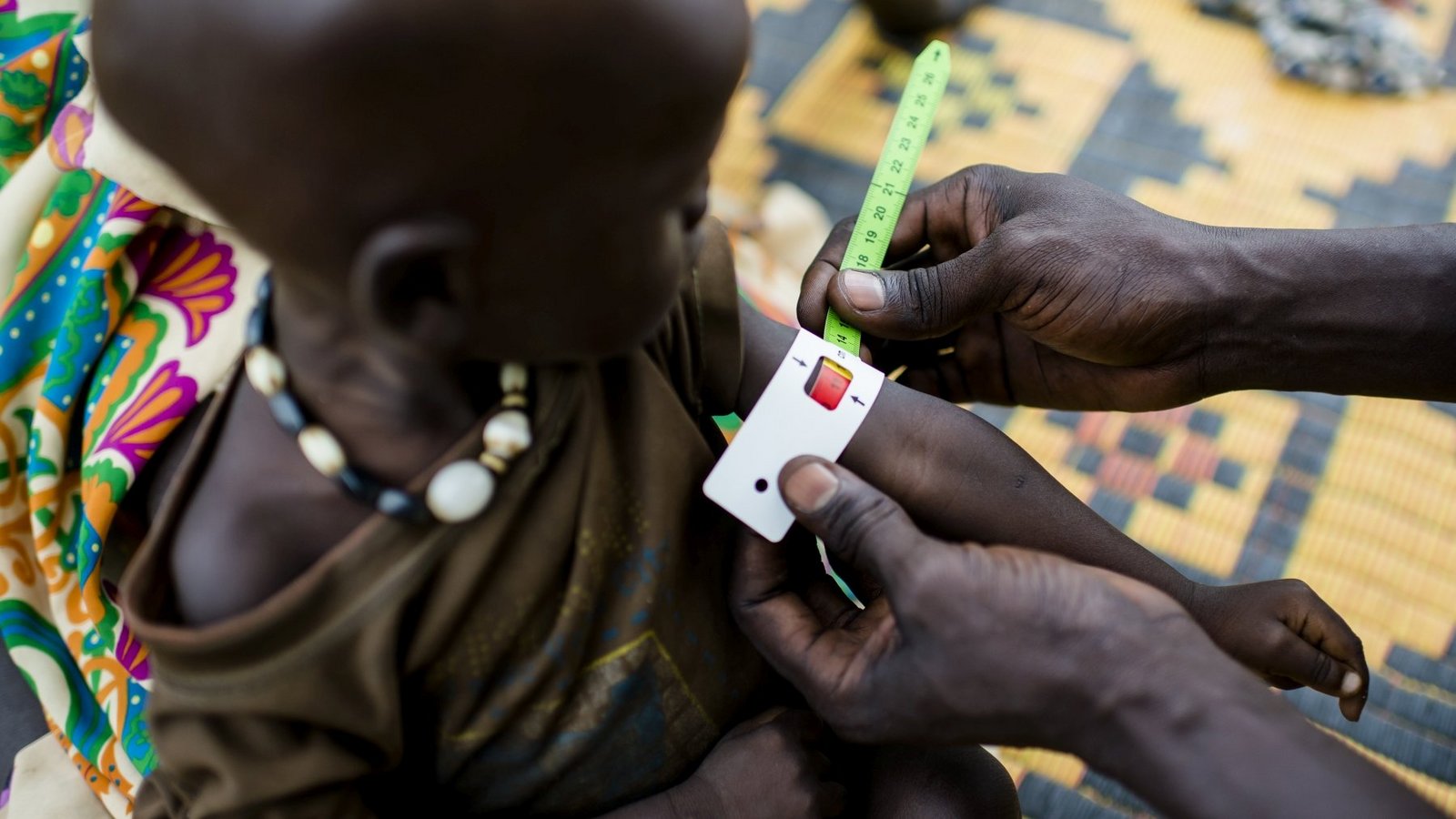 Ein Mitarbeiter von Help misst den Oberarm-Umfang eines Kindes im Südsudan, um den Grad der Unterernährung zu ermitteln.